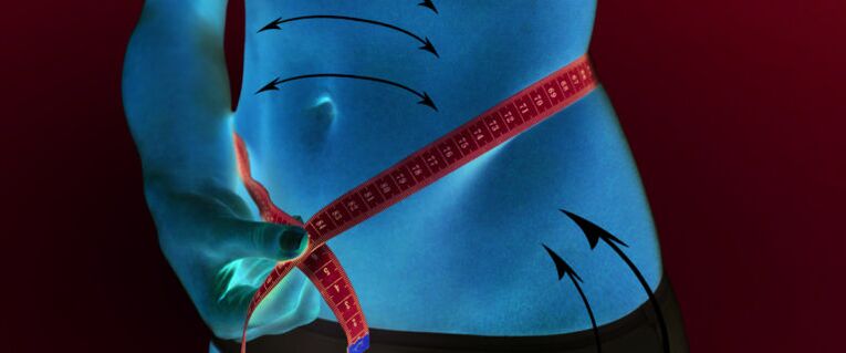 Reduction of subcutaneous fat from the abdomen and sides as a result of losing weight in one week